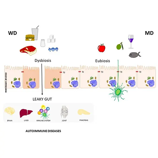 Autoimmune Profile (Gastrointestinal)